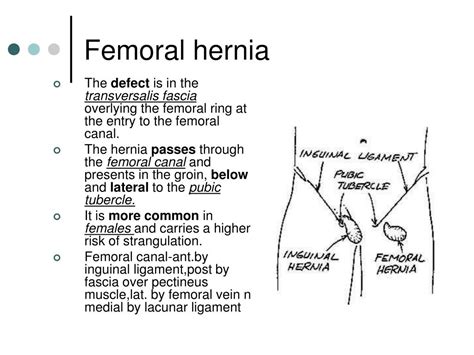 femoral pronunciation|what is a femoral hernia.